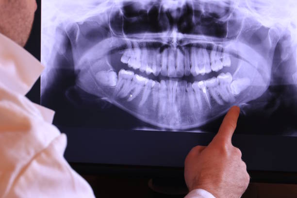 Best Orthodontic Emergency Dentist in North Fort Myers, FL